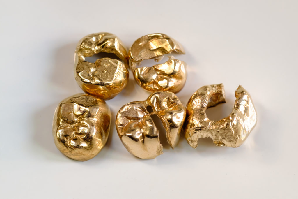 dental gold collection in Switzerland