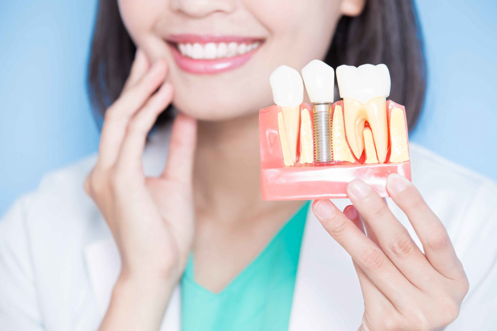 dental implants Fribourg Lausanne Aigle HELVIDENT
